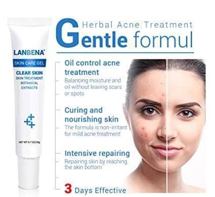 LANBENA Acne Treatment Gel Acne Cleaning Blackhead, 3 image