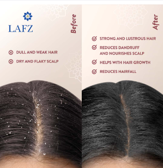 Lafz Onion Seed Essential Oil For Hair (100 ml), 4 image
