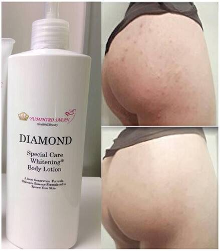 Diamond Special Care Whitening Body Lotion For Dry Skin, 4 image