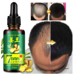 Ginger Germinal Anti Hair Loss & Hair Growth Oil- 30ml
