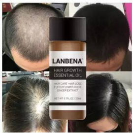 LANBENA Fast Powerful Hair Growth Essential Oil -20 ml