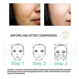 Dr Rashel Whitening Fade Spots Face Serum - Reduces Pigmentation Smoother and Whiter Skin, 5 image