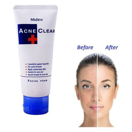 Mistine Acne Scar Clear Oil Blemish Control Facial Foam Face Wash-85g (made in Thailand)