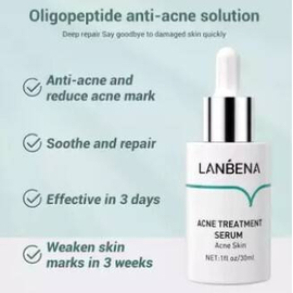 Lanbena Acne Treatment Serum -30ml, 2 image