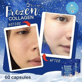 Frozen Collagen 2in1 Whittening X10 Anti Aging vitamins, 2 image