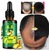 Ginger Germinal Anti Hair Loss & Hair Growth Oil- 30ml