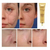 LANBENA Skin Scar Remove Kit 3Pcs/Set - [Combo], 3 image