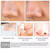 Lanbena Pore Treatment Essence, 3 image